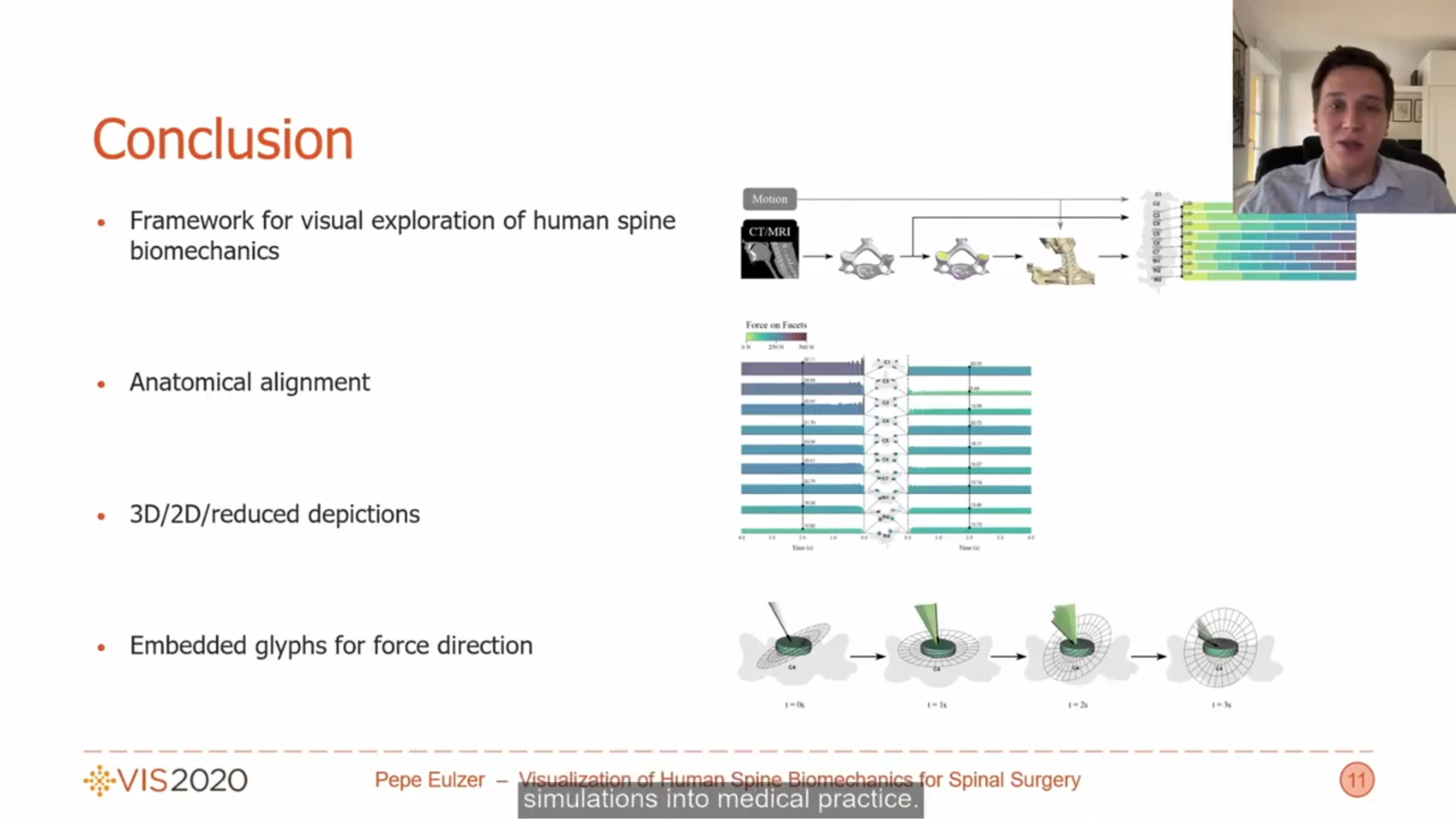 Visualization of Human Spine Biomechanics for Spinal Surgery